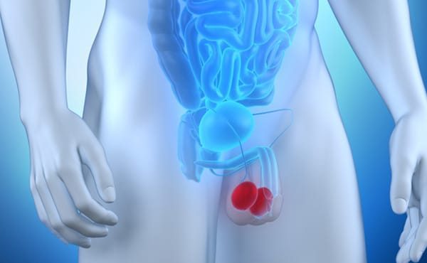 Câncer de Testículo: Entenda, Previna e Saiba Como Tratar