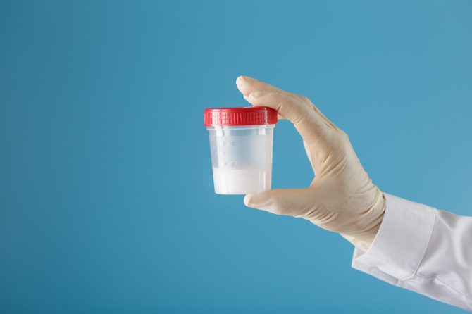 Sangue na Urina e no Esperma: Quando é Sinal de Alerta e Como a UROSERV Pode Ajudar