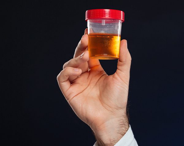 cancer-de-bexiga-sinais-e-sintomas