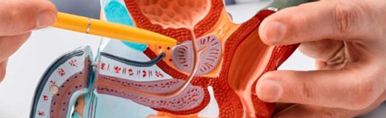 prevencao-de-cancer-de-prostata