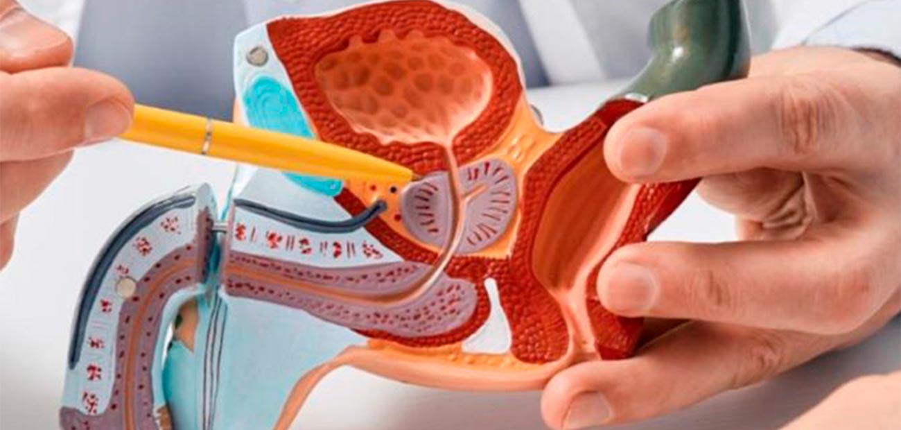 prevencao-de-cancer-de-prostata