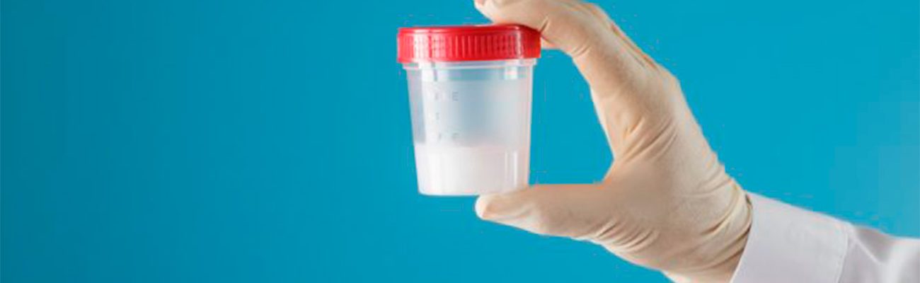 sangue-na-urina-e-no-esperma