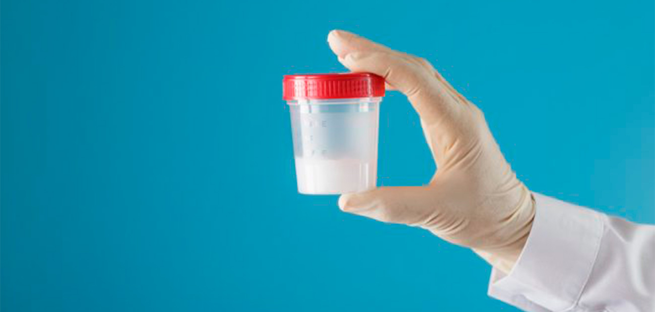 sangue-na-urina-e-no-esperma