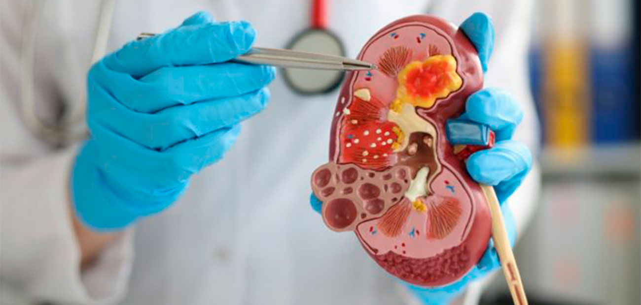 tumores-urologicos tumores-urologicos